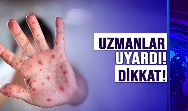 UZMANLAR UYARDI, ARTAN KIZAMIK VAKALARINA DİKKAT!