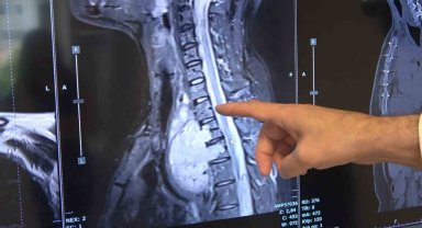 Portakal büyüklüğündeki tümöre başarılı operasyon