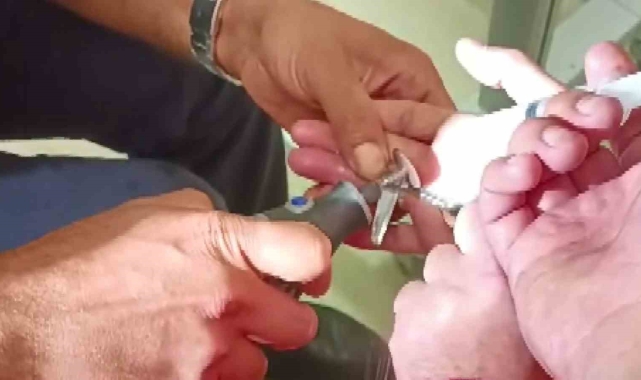 Yüzüğe sıkışan parmağı itfaiye ekipleri kurtardı