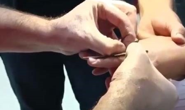 Kadının parmağına sıkışan yüzük kesilerek çıkartıldı