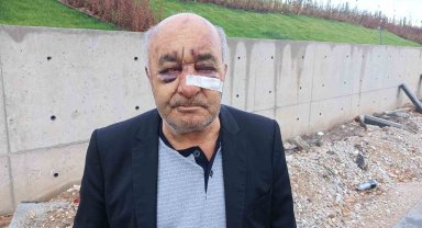 Öldüresiye dövülen taksici korku dolu o anları anlattı