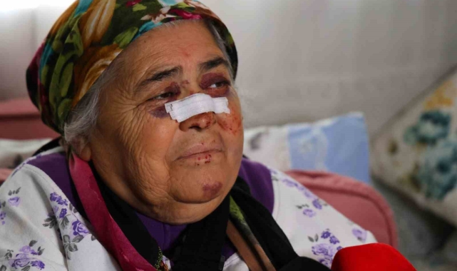 Otomobilin çarptığı yaşlı kadın: "Gözümün içine bakıp kaçtı"