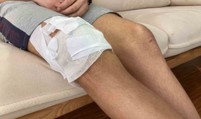 Köpek saldırısına uğrayan çocuğun ailesi, Çankaya Belediyesine dava açmaya hazırlanıyor