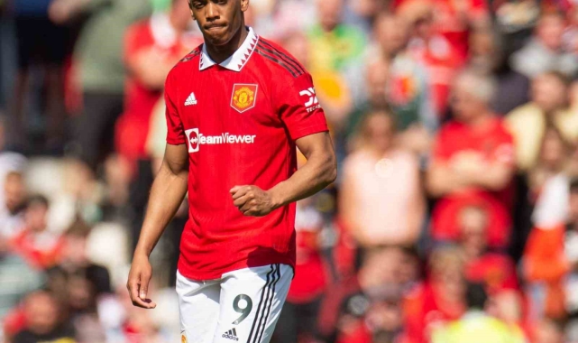 Manchester United'da Anthony Martial, yaklaşık 10 hafta sahalardan uzak kalacak