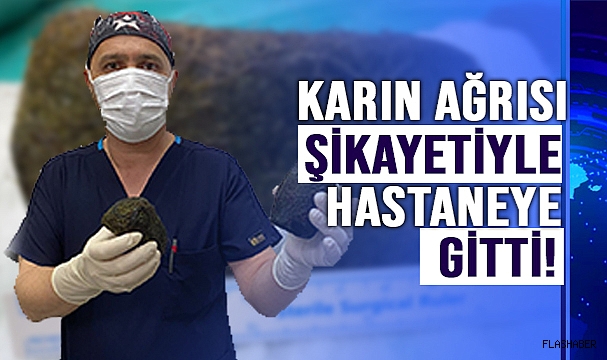 MİDESİNDEN 2 KİLO SAÇ ÇIKTI!