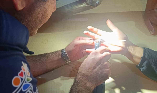 Parmağına yüzük sıkışan vatandaşın imdadına itfaiye yetişti