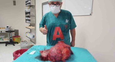 Karın ağrısı şikayetiyle gitti, 10 kiloluk dev tümör çıkartıldı