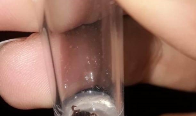 Konya'da bir mahallede 3 kişiye kene yapıştı