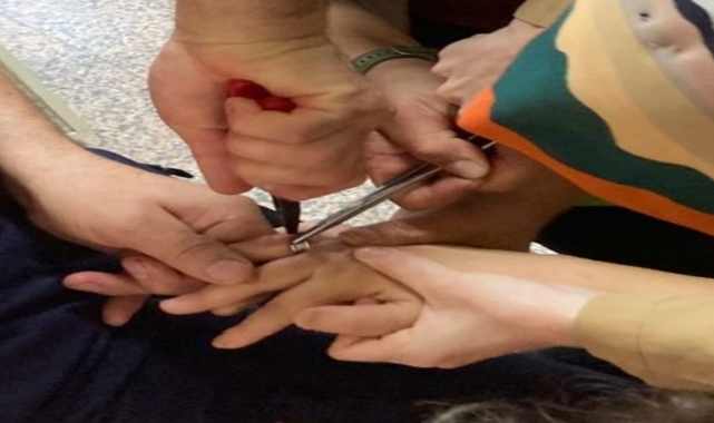 Zonguldak'ta parmağına yüzük sıkışan kadını itfaiye ekipleri kurtardı