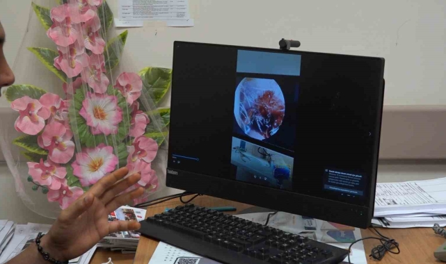 70 yaşındaki kadının kulağında hareket eden kene operasyonla çıkarıldı