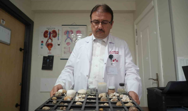 Hastaların çilesi olan 'taşlar' üroloji uzmanına koleksiyon oldu