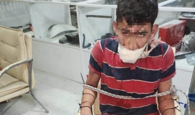 İşkence yapıp böcek yedirdiler, kerpetenle dişlerini söktüler