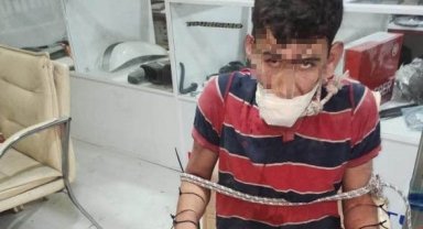 İşkence yapıp böcek yedirdiler, kerpetenle dişlerini söktüler