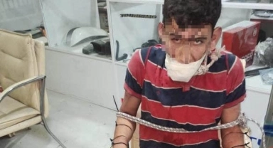 İşkence yapıp böcek yedirdiler, kerpetenle dişlerini söktüler