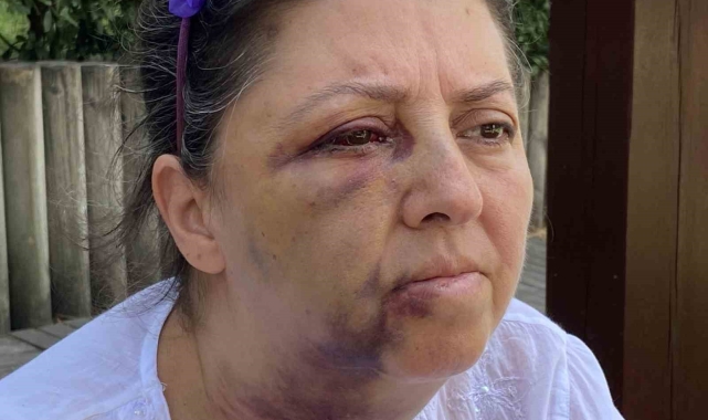 Küçükçekmece'de kedi besleyen iki kız kardeşi komşularının saldırısına uğradı