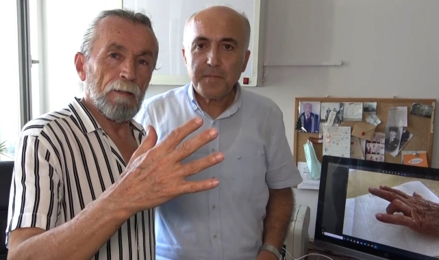 'Tetik parmak sendromu'nu iyileştiren bitkisel karışım geliştirdi