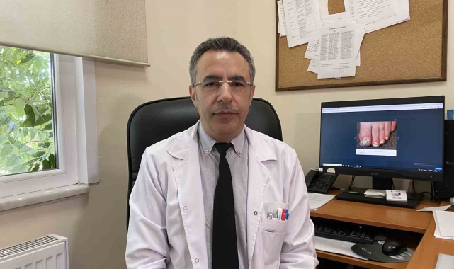 Uzmanlar uyarıyor: "Mantar enfeksiyonlarında artış görüyoruz, tedaviye direnç söz konusu"