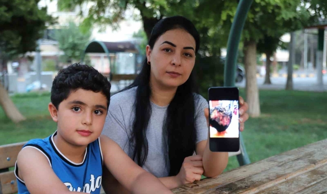 Sokak köpeği saldırısında ağır yaralanan çocuktan 'köpekler toplansın' çağrısı