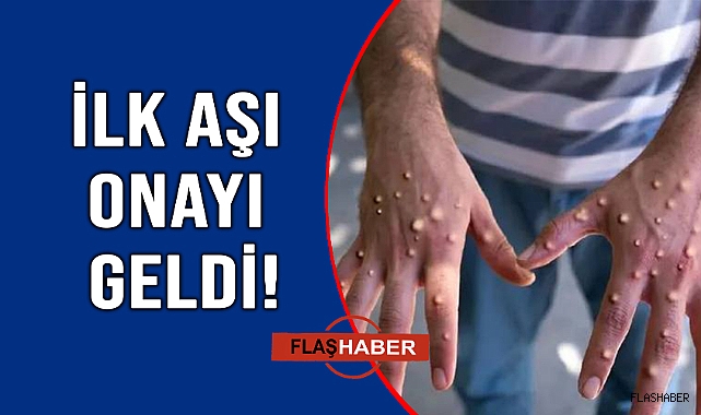 MAYMUN ÇİÇEĞİNE KARŞI İLK AŞI ONAYLANDI!