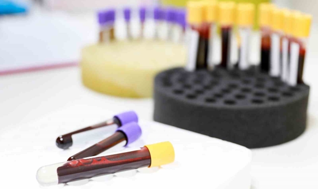 Türk Kızılay, 1 milyon kök hücre bağışçı adayıyla nakil bekleyen hastalara umut oluyor