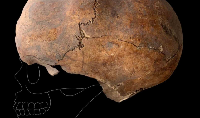 Yassıhöyük'te 6 bin yıllık kafatası bulundu