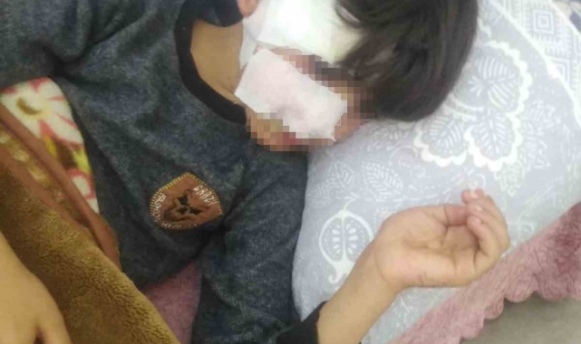 Gaziantep'te 8 yaşındaki çocuğa 5 sokak köpeği saldırdı
