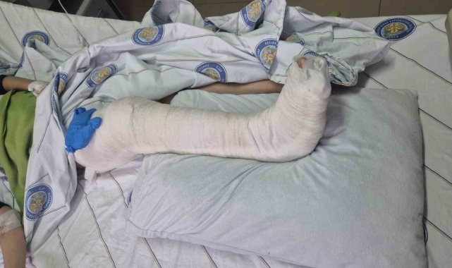 Diyarbakır'da köpeklerden kaçan çocuğun bacağı kırıldı