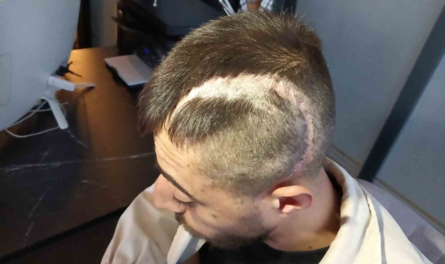 Patronunun öldüresiyle darp ettiği çalışan yüzde 32 fiziksel engelli kaldı