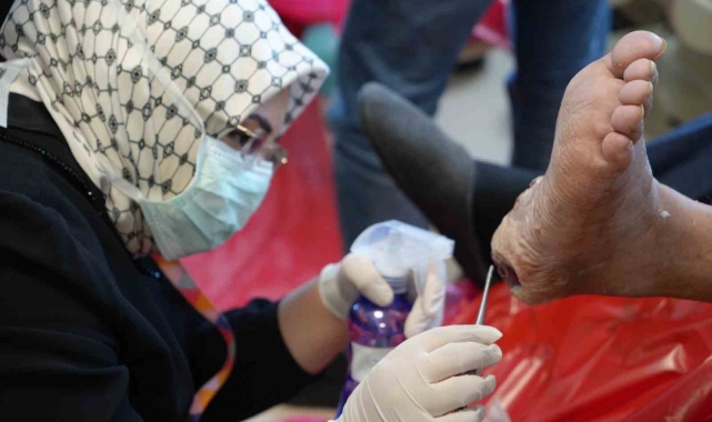 Sinek larvaları ile yara tedavisi: Çürümüş dokuları yiyorlar, bölge kesilmekten kurtuluyor