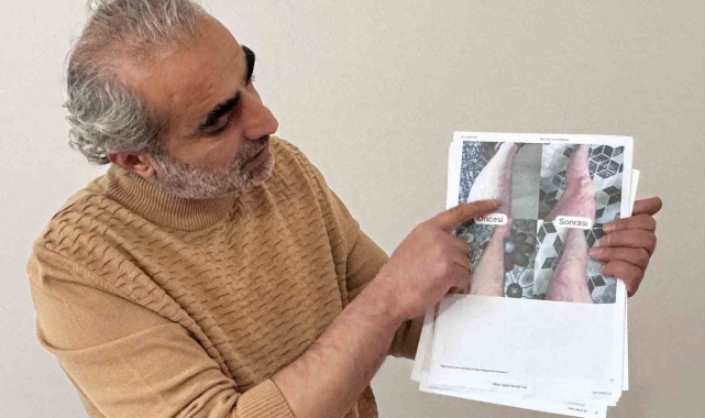 Jeoloji mühendisi sedef, egzama, uyuz ve vitiligo için krem üretti