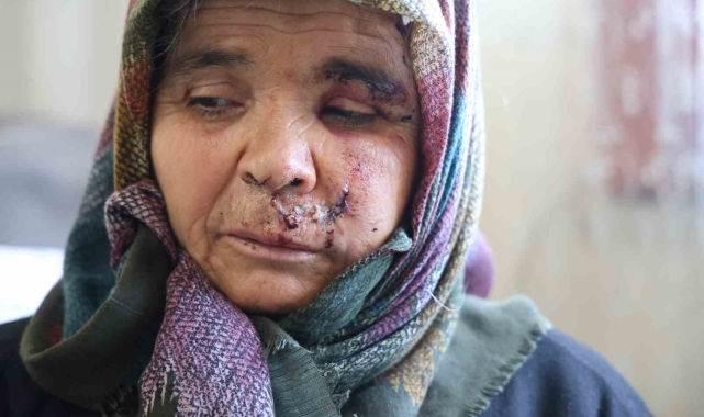 Kızlarının evine ziyarete giden anne ve baba köpeğin saldırısına uğradı