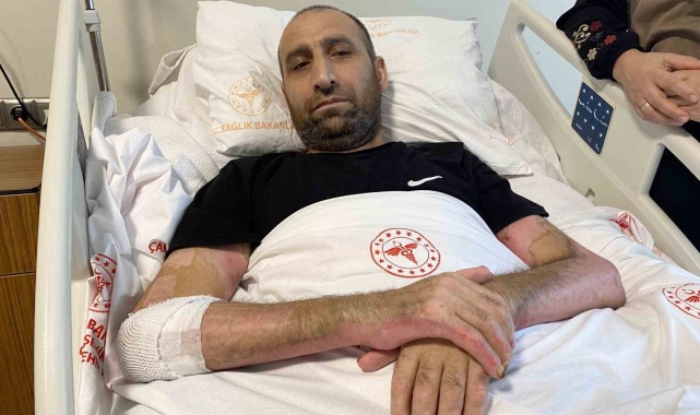 Mangal yapmak isterken 'Tiner faciası': Vücudunun yüzde 80'i yandı, patlamanın şiddeti kameraya yansıdı