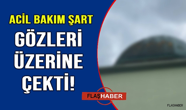 Estetik sorun yaşatıyor