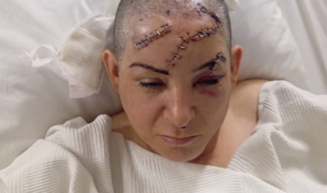 Nevşehir'de eşinin satırla ağır yaraladığı kadın yaşadığı dehşeti anlattı