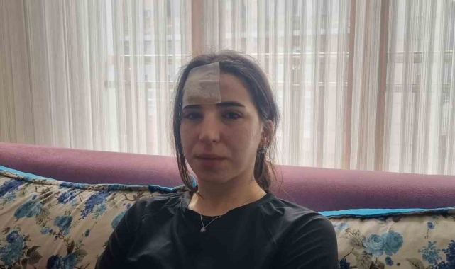 Esenyurt'ta başıboş köpekler bir kadına saldırdı