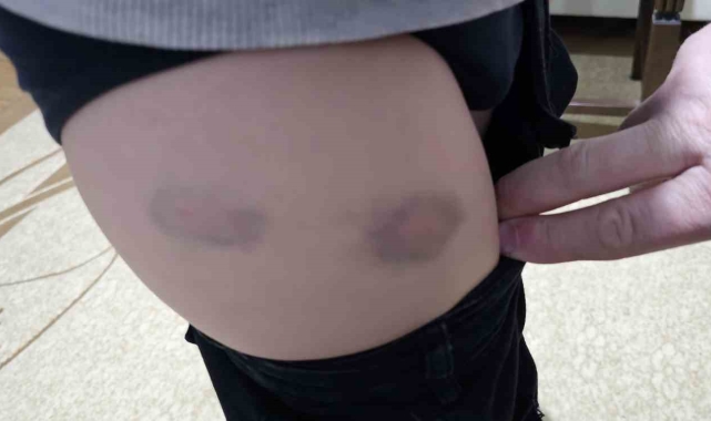 Kastamonu&#039;da sokak köpekleri küçük çocuğa aynı gün içinde iki kez saldırdı