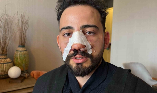 Siparişler geciktiği için gitmek isteyen müşteriye restoran çalışanlarından öldüresiye darp