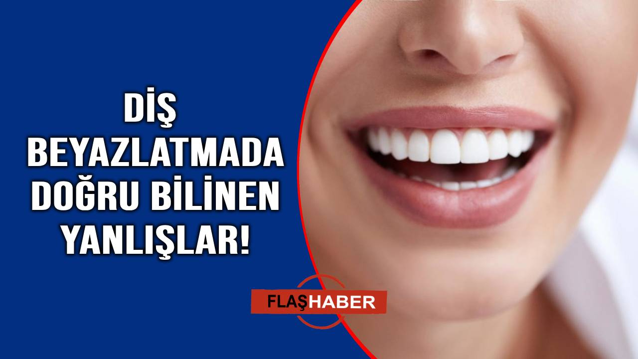 Işıl ışıl görünsün derken dişinizi kaybedebilirsiniz!