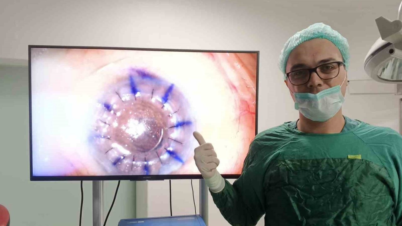 83 yaşındaki hastaya başarıyla kornea nakli yapıldı