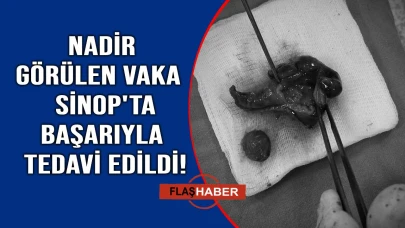 Erik çekirdeği hayatına mal oluyordu