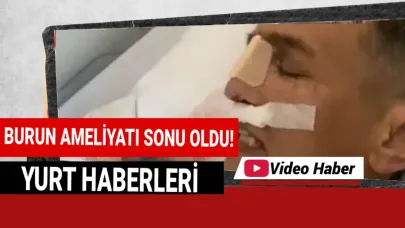 Sadece daha estetik bir burun istemişti