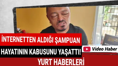 Saçlarını siyahlatmak istemişti, hayatının şokunu yaşadı