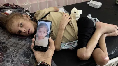Gazze’de yetersiz beslenme sonucu 12 kiloya düşen 7 yaşındaki May yürüme yetisini kaybetti