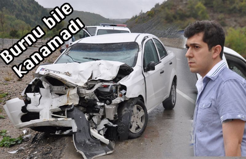 Burnu bile kanamadı