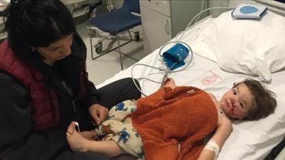 Başkentte pitbull dehşeti: 2 çocuk yaralandı