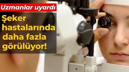 Göz tansiyonu ve katarakt, şeker hastalarında daha fazla görülüyor