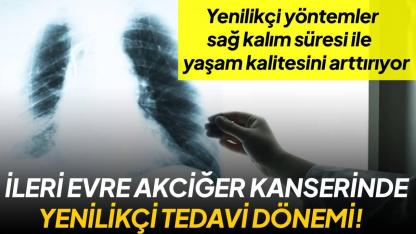 Akciğer kanserinde devrim: İmmünoterapi ile uzun süreli yaşam şansı