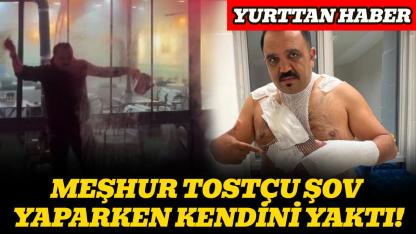 Şov yapmak isterken kendini yaktı