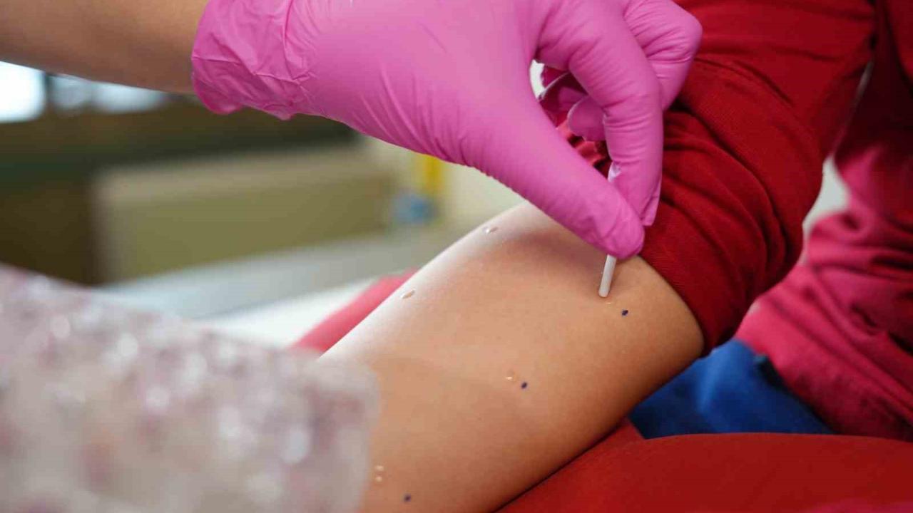 Baharla birlikte polen alerjisi alarmı