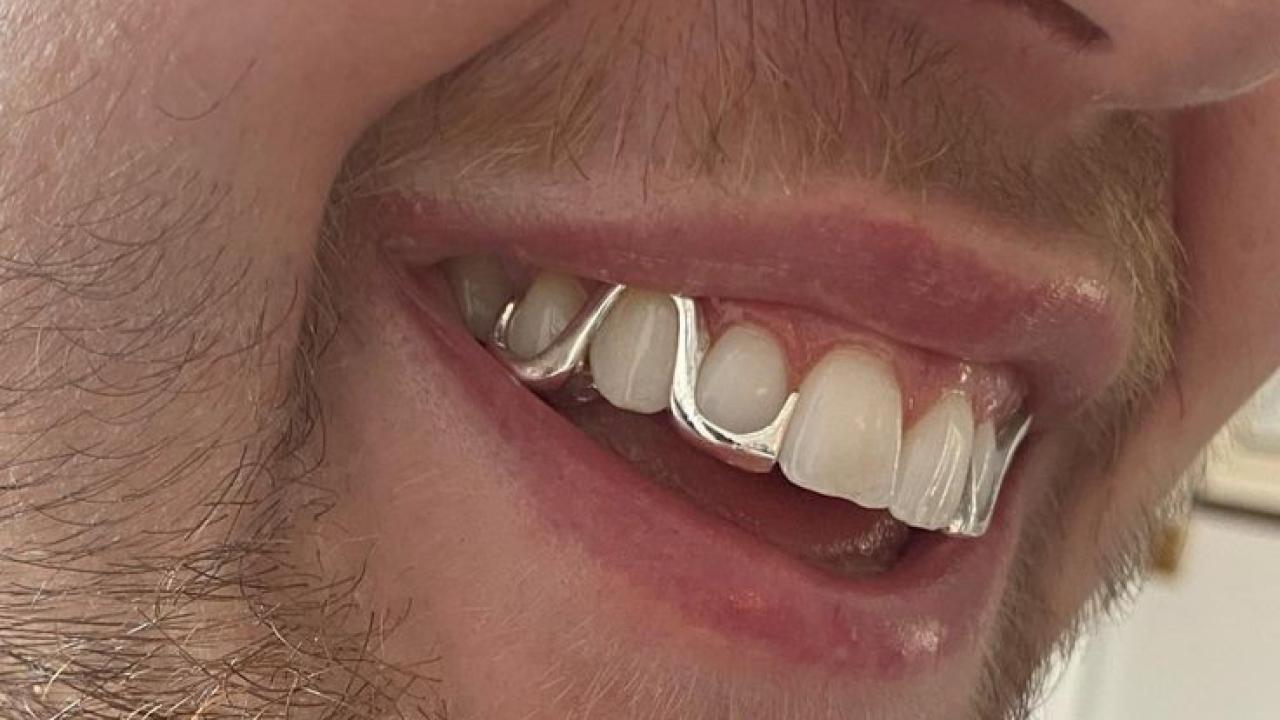 Erkeklerde diş estetiğinde yeni moda: Grillz
